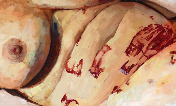 Thumbnail for Pain on canvas: A portrayal of endometriosis